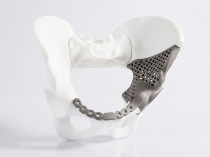 骨科应用,3D 打印